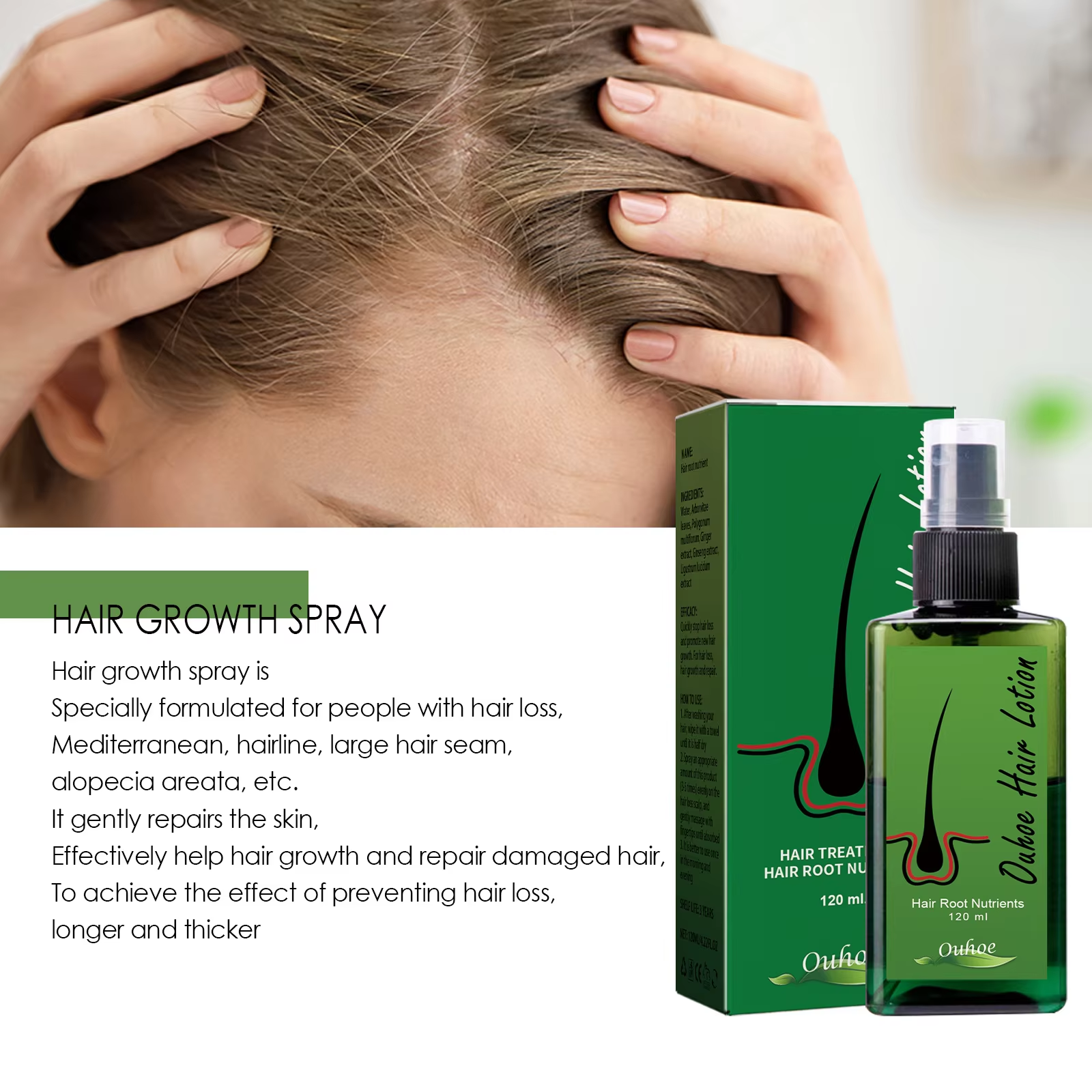 Hair Growth Spray Anti Hair Lo – Root Stimulator Liquid Bewertung und Preis